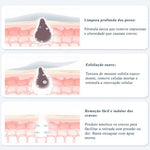 ViyaClean™  - Sérum de Limpeza Removedor de Cravos