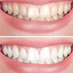 Clareador Dental Viya White - PROMOÇÃO (50% DE DESCONTO)