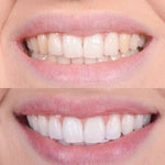 Clareador Dental Viya White - PROMOÇÃO (50% DE DESCONTO)