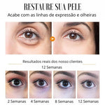 Sérum Rejuvenescedor Anti Rugas e Olheiras – Radiant Eyes