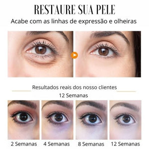 Sérum Rejuvenescedor Anti Rugas e Olheiras – Radiant Eyes