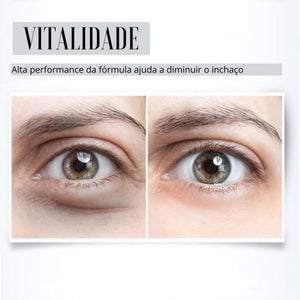 Sérum Rejuvenescedor Anti Rugas e Olheiras – Radiant Eyes