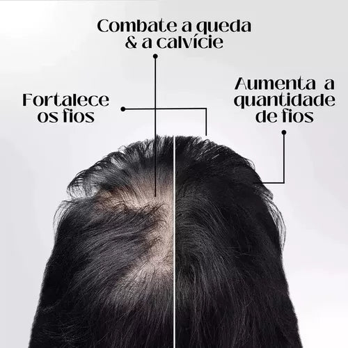 Repair Hair Crescimento Capilar