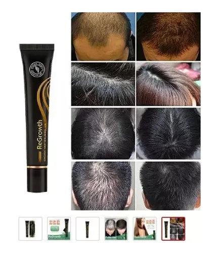 Repair Hair Crescimento Capilar