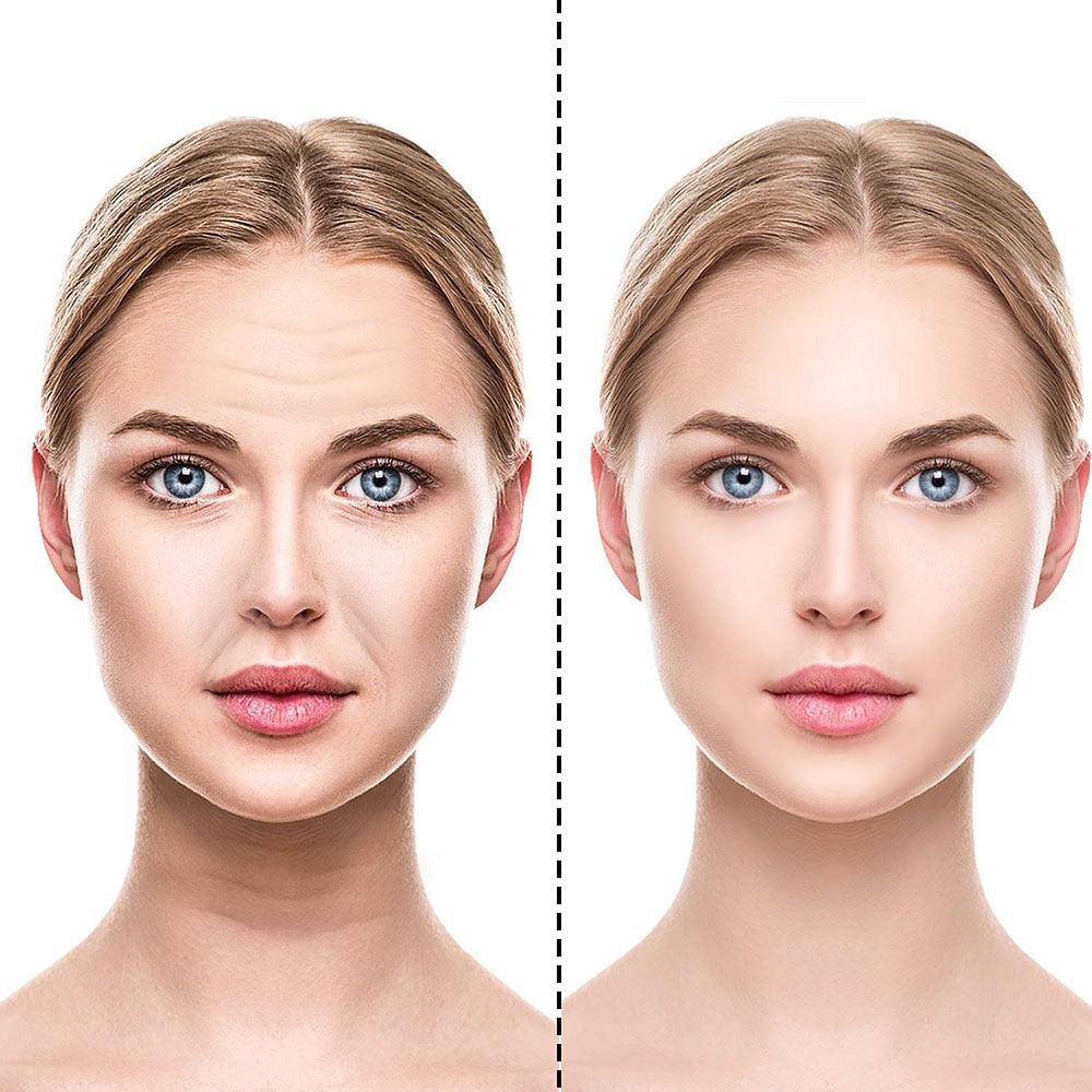 Adesivos de Silicone Anti Rugas e Linhas de Expressão - RevonaSkin™
