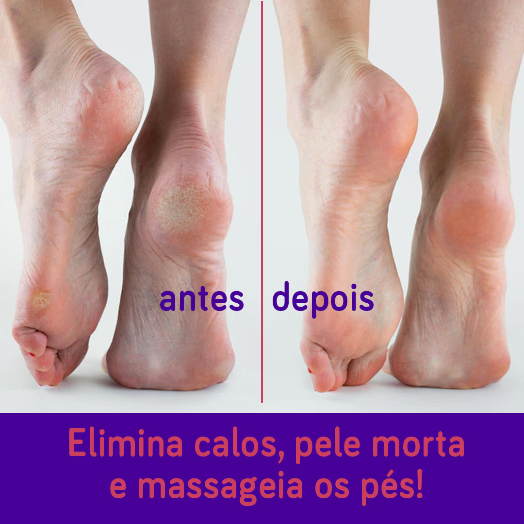 Lixa para Pés Bonitos e Saudáveis – Pedicuro Velvety Feet