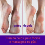 Lixa para Pés Bonitos e Saudáveis – Pedicuro Velvety Feet