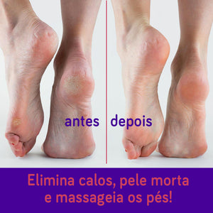 Lixa para Pés Bonitos e Saudáveis – Pedicuro Velvety Feet