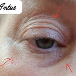 Sérum Rejuvenescedor Anti Rugas e Olheiras – Radiant Eyes