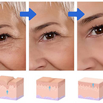 VisionLipo™ 3D - Revitaliza os Olhos 6 Em 1