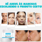 Creme para Melasma - Melaslow